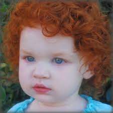 Dark Skin White Hair Google Search Red Hair Blue Eyes Red Hair Green Eyes Red Curly Hair