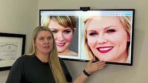 Let’s talk about Kirsten Dunst's iconic smile! 😁✨ There's been a lot of  buzz about whether she’s had braces or veneers, but in interviews, she’s  shared that she loves her natural, crooked smile., Dr. ...