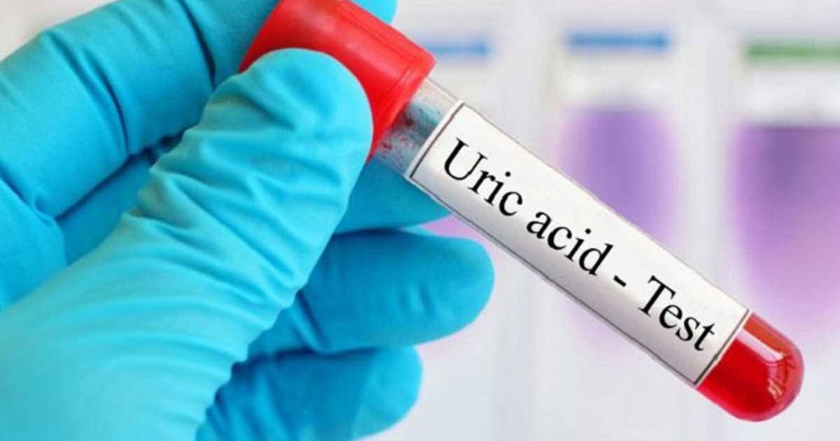 URIC ACID product image