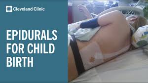 Image result for Active Labor Anesthesia