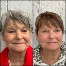 Stacey Koch, APRN. Nurse Injector