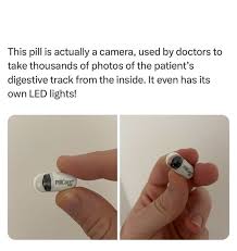 Image result for Wireless Capsule Endoscopy