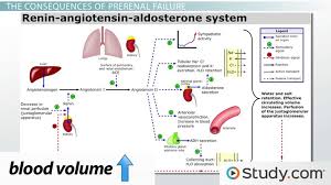 Image result for Postrenal Failure