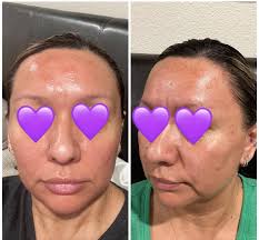 Foxy Medical Spa By Hope In Denver CO