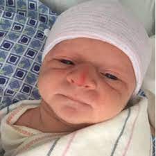 Nose Broken During Delivery September 2015 Babies Forums What To Expect
