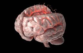 Ischemic, due to lack of blood flow, and hemorrhagic, due to bleeding. Middle Cerebral Artery Stroke Causes And Symptoms