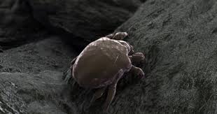 Bird Mites In Hair Dust Mites See You Re Never Really Alone Eat Clothing Dust Mites Bed Bugs