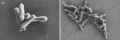 Image result for Asplenium markusbeckeri