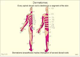 dermatomes mycerebellarstrokerecovery