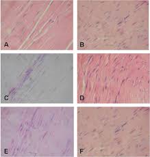 Current science courses in histology, anatomy and embryology and complement the virtual microscopy used in the current medical course. Tendon Histology Slides H E 40x A Longitudinal Section Of A Download Scientific Diagram