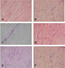 So sliding with double g wouldn't work either, and it still wont merge at center and requires more input. Tendon Histology Slides H E 40x A Longitudinal Section Of A Download Scientific Diagram