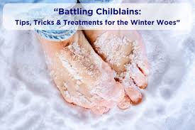 Image result for Chilblains