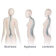 Kedudukan normal dipertimbangkan apabila tidak ada lekukan bilah bahu dan bahu, sedangkan kepala lurus dan tulang belakang flexes dengan lancar, tanpa kinking dan protrusi. Postur Yang Baik Bagi Tubuh