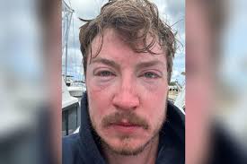 Like a Hot Iron.' BC Man's Ultra-Marathon Hawaiian Swim Is Scuttled by  Jellyfish