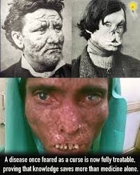 The most profitable disease in history doesn't exist. It was invented in a  boardroom in 1921. If you use mouthwash every morning, you are treating a  "medical condition" created by an ad