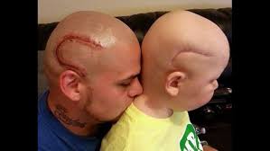3 cancer constellation tattoo designs and ideas. Dad Got Tattoo To Help Son Feel Better About Cancer Surgery Scar Wnep Com