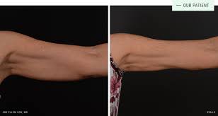 Aesthetic solutions aesthetic solutions 5821 farrington rd., ste. Aesthetic Solutions 5821 Farrington Rd Ste 101 Chapel Hill Nc Dermatologists Mapquest