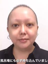 乳がん 歯科口腔外科 蜂窩織炎