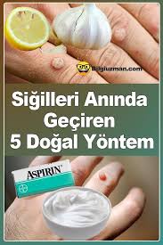 sigilleri aninda geciren 5 dogal yontem saglik dogal saglik dogal