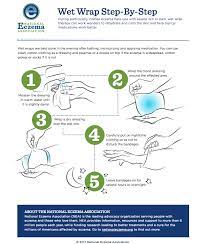 Pin On At Home Eczema Treatment