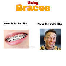 Mmmm Metal Teeth Memes
