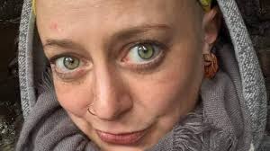 Early intervention essential, says woman with long-term eating disorder