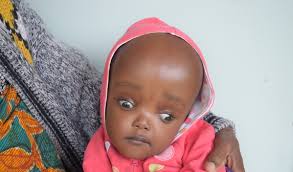 Patrick from Tanzania raised $1,238 to fund brain surgery.