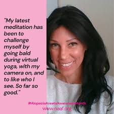 Since becoming a NAAF advocate, Christine Gauthier has met with her  congressman in Washington, DC, represented the alopecia areata community at  Hill Day and met privately with legislators to share her story.