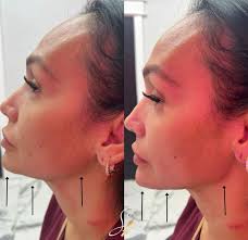 ✨ Skinsational Aesthetics x Innerverse Pilates Studio ✨ 2-Day Wellness  Event