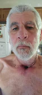 Fundraiser by Michele Lang : Support Ed Charnock's Cancer Recovery Journey