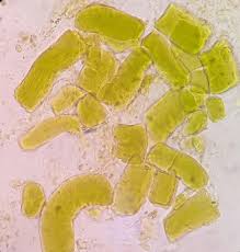 I was diagnosed with crohns about 18 months ago and was diagnosed have had undigested food in my stool for several years prior to diagnosis. Undigested Food Clinical Laboratory Practice Clp Facebook