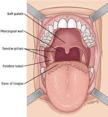 Image result for tonsilla palatina