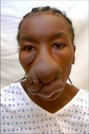 ድሮን በዘንድሮ ‹ DRON BEZENDRO › )))