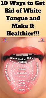10 Ways To Get Rid Of White Tongue And Make It Healthier Healthy Stuff Health How To Get Tips
