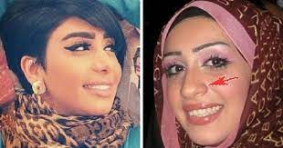 ممثلات خليجيات بعد عمليات تجميل الأنف وفروقات واضحة