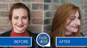 How to Apply (Attach) a Non-Surgical Hair Replacement System for Women with  Charlotte