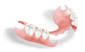 Will eating with new dentures be difficult? Partial Dentures Removable Best Comfortable Costa Mesa Ca California Dentistry At Its Finest