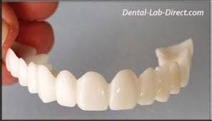 Veneers Removeable Veneer Dentures Flippers Pontics Veneers Teeth Chipped Tooth Snap On Smile
