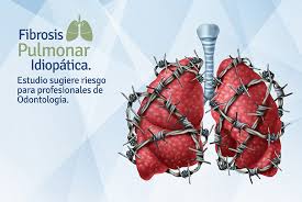 No hay cura para la fp, pero la enfermedad a menudo se puede controlar mediante medicamentos. Fibrosis Pulmonar Idiopatica Estudio Sugiere Riesgo Para Profesionales De Odontologia Blog Bioseguridad Cristofoli