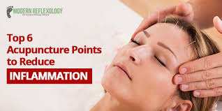 6 acupuncture points to reduce chronic inflammation take