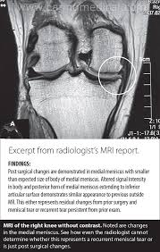 During arthroscopy, you may have a general or regional anesthetic. Is My Mri Accurate Is It Reliable Caring Medical Florida