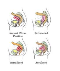 Image result for cervix position