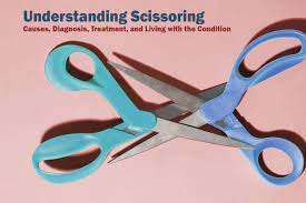 Understanding Scissoring: Causes, Diagnosis, Treatment, and Living with the  Condition - SS Publishers & Distributors