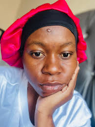 Fading a scar: what has worked for you?