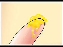 Flujo Vaginal Amarillo Y Sus Causas Youtube