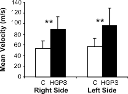 Mechanisms Of Premature Vascular Aging In Children With