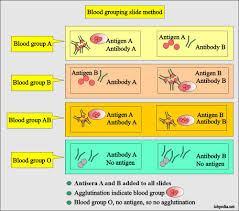 Take another test tube with protein solution to act as a control to compare the difference in color after the completion of the experiment. Blood Banking Part 1 Blood Groups Abo And Rh System Blood Grouping Procedures Labpedia Net