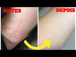 pin em saude e higiene pessoal