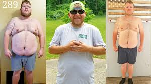 If you decide to move forward with surgery, you will most likely: Gastric Bypass Before And After Weight Loss Youtube