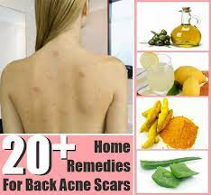 Learn which ones are backed by science and if they could be right for you! Pin On Diy Beauty